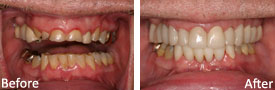 Man before and after