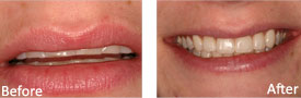 Woman before and after